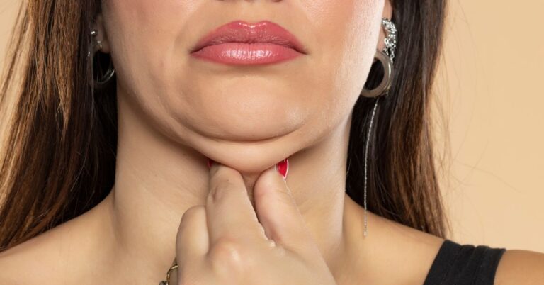 Vežbe za podbradak žena